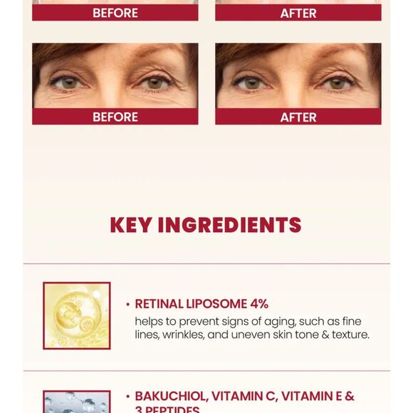 KSECRET, SEOUL 1988 Eye Cream: Retinal Liposome 4% + Fermented Bean - Picture 6 of 14